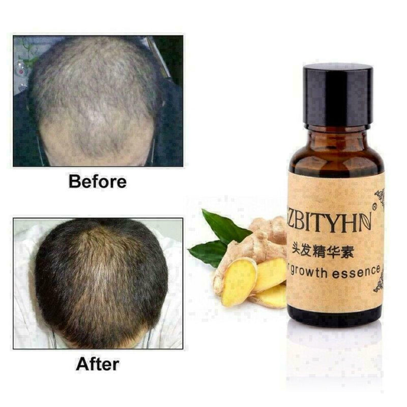 20ml Hair Care Growth Essence Anti Hair Loss Hairstyle Keratin Liquid Dense Y4F9