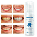 Teeth Whitening Mousse Tooth Whitening Dental Tool Teeth White Hot Cleaning M4X8