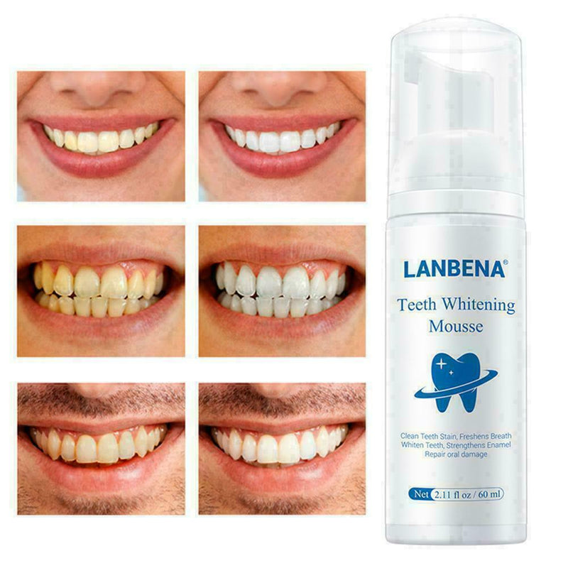 Teeth Whitening Mousse Tooth Whitening Dental Tool Teeth White Hot Cleaning M4X8