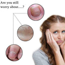 Ingrown Toe Nail Lifter Podiatry Chiropody Instruments Good C8O5 Brand G2B0