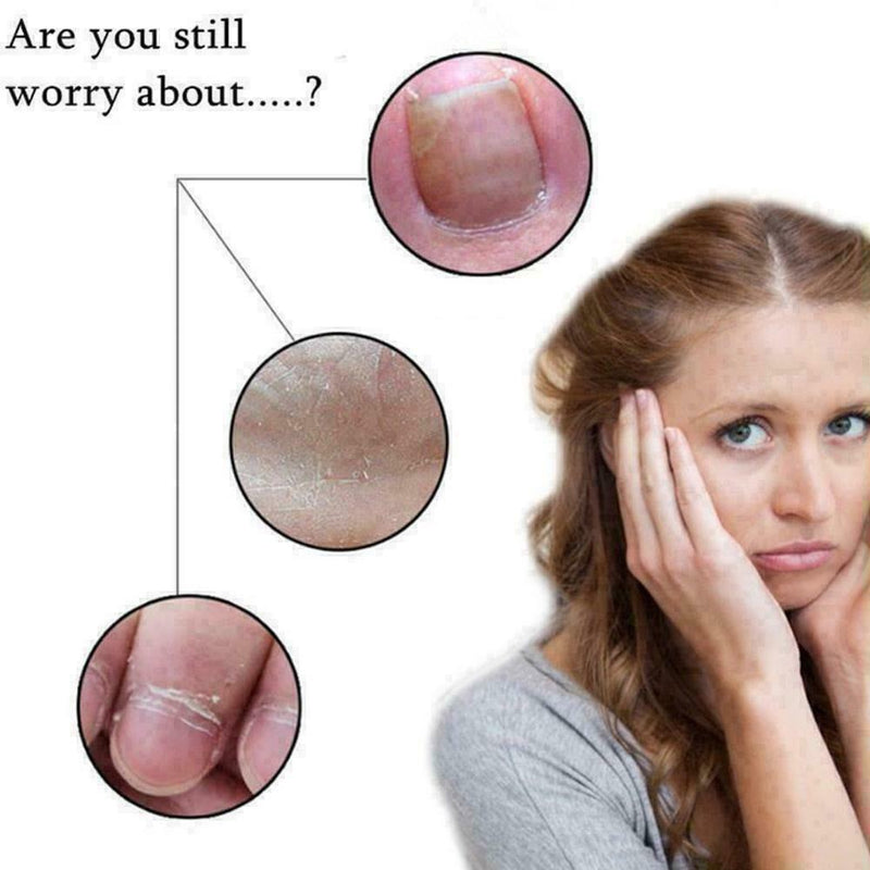 Ingrown Toe Nail Lifter Podiatry Chiropody Instruments Good C8O5 Brand G2B0