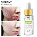 Vibrant Glamour Tea Tree Repair Face Serum Acne Scar Shrink Pores Face Seru I6N4