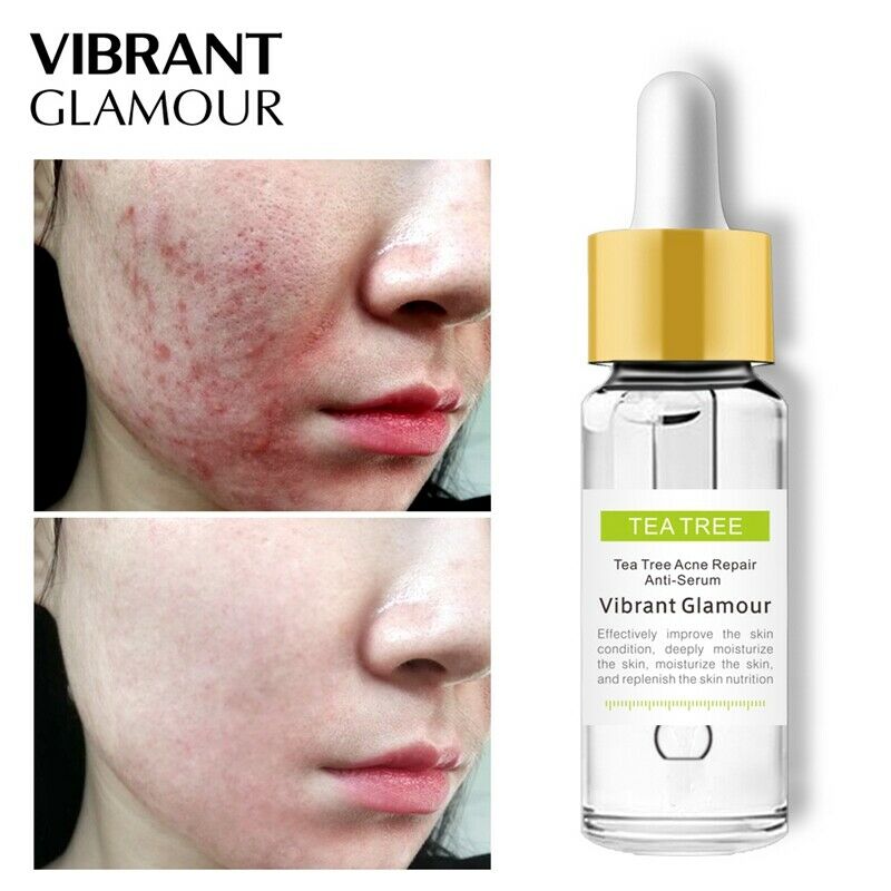 Vibrant Glamour Tea Tree Repair Face Serum Acne Scar Shrink Pores Face Seru I6N4