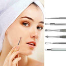 Blackhead Remover | Pimple Extraction Blemish Suction Removal Tools Kit