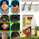 Hair Growth Essence Dense Regrowth Ginger Serum Oil Anti Loss Treatment X8D4