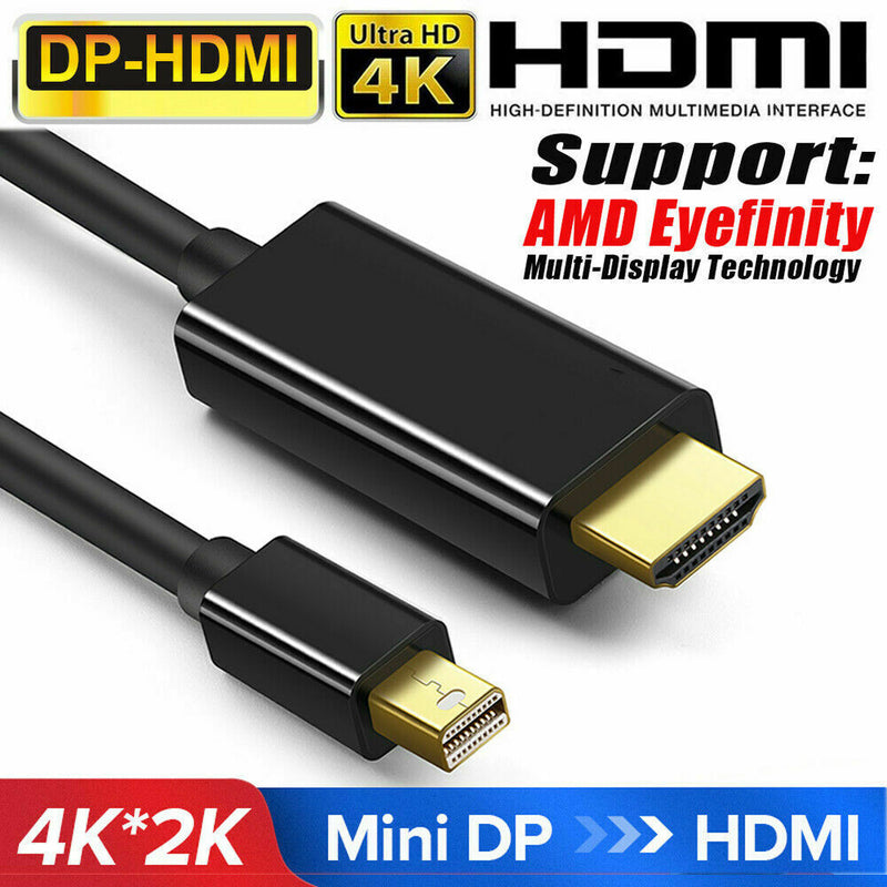 1.8M Mini DP Display Port Thunderbolt 2 to HDMI Cable Adapter For MacBook Pro bs