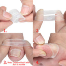 Silicone Ingrown Toenail Correction Tool Invisible Ingrown Toe Nail Treatmen Cy