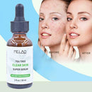 Pure Natural Tree Essential Oil Acne Treatment Face Care Z Skin H4F4 H2F6