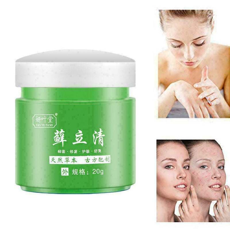 100% Natural Dry Irritable Itchy Skin Moisturiser W6Q9 F9O6