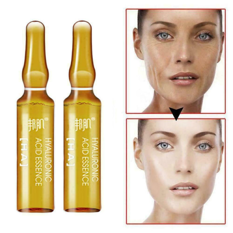 Whitening Spotless Ampoule Serum (Set of 7) W1O7