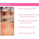 1x Silicone Massage Vacuum Body Cups Set Anti Cellulite Cupping Ne!E