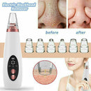 Blackhead Remover Vacuum Extractor Pro Suction Facial Acne Pore Effectiv Cl Q2X4