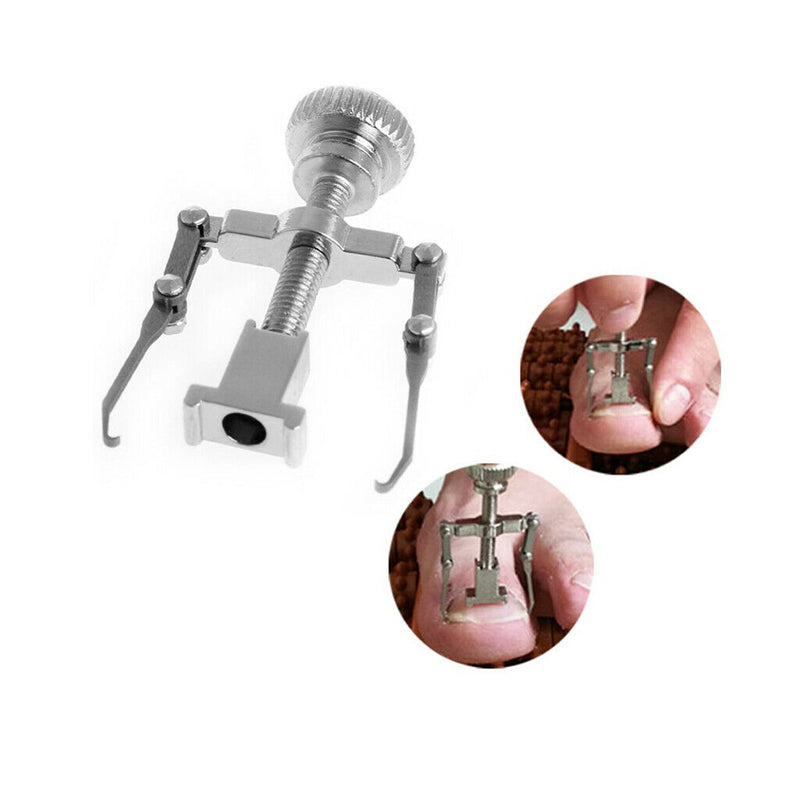 Ingrown Toenail Correction Tools Stainless Steel Toe Nail Corrector Recover Foot