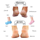 Moisturizing Socks,Gel Socks Soft Moisturizing Gel Socks,Gel Spa Socks for
