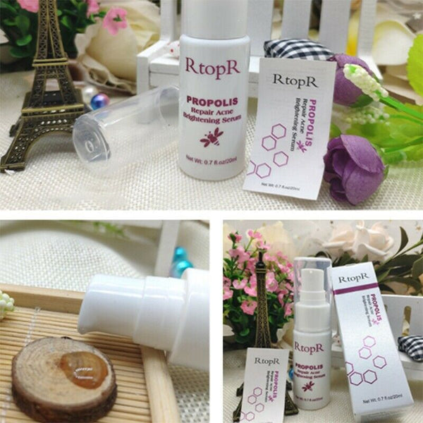RtopR Propolis Repair Acne Brightening Serum Acne Scar Spots Cleaning Serum K9M4
