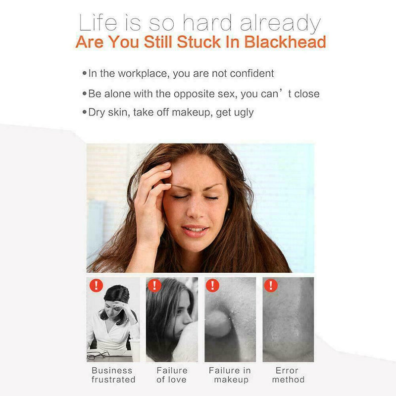 Electric Facial Skin Care Pore Blackhead Remover Cleaner Acne Vacuum Sucker O6J5