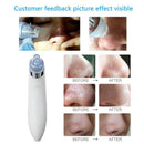 Facial Acne Blackhead Remover Vacuum Suction Pore Clean Machine (White C)