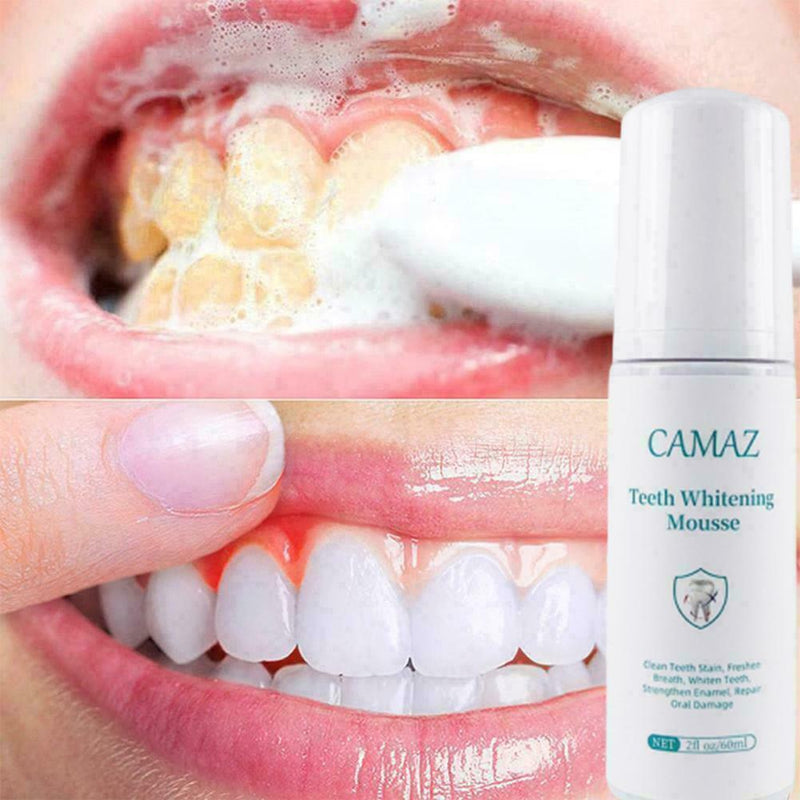 Remove Tooth Stains Whitening Fine Toothpaste Mousse Nice Teeth Cleaning O6C4