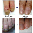 Special Nail Treatment Liquid Grey Nail Clear Repair Enhanced Gray Nail Tre