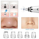 Electric Blackhead Pores Acne Clean Surface Instrument Beauty Cleaner Tools