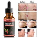 Skin Whitening Oil Brightening Dark Spot Removal 30ml Quality Essence Care V6S1