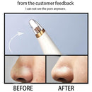 Electric Blackhead Remover Face Pimple Pore Acne Removal Skin Care Device