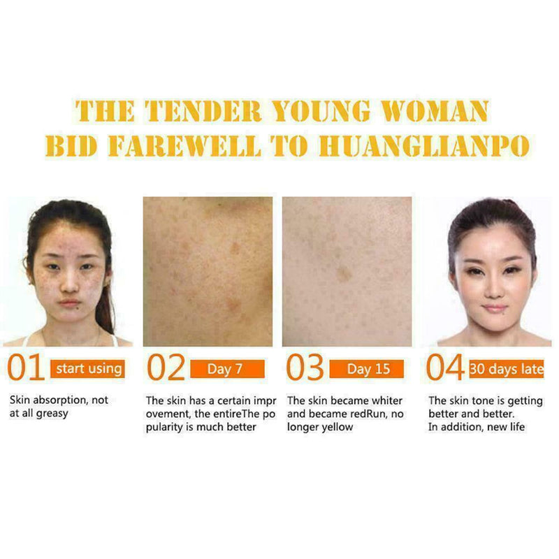 100% PURE VITAMIN C + HYALURONIC ACID SMOOTHING FACE B4D4 SERUM I5I0
