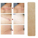 New Medical Scar Away Patch Silicone Gel Sheet Wound Treatmen Removal R0R3 Z2U3