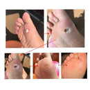 Skin Tag Removal, All Natural, Home Skin Care, Remove Skin Tag Efficiently, Best