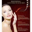 15ml Crema Acne para ELIMINA Barros Manchas Espinillas I8P7 Tu RECUP Piel L U6O8