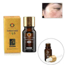 Ultra Brightening Spotless Oil Anti Dark Natural Spots Pure Oil Skin Care F D2Q8
