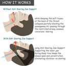Snore Belt Stop Snoring Chin Strap Apnea Jaw Support AU Solution Sleep D8O2