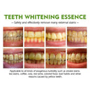 30g Instant Teeth Whitening Pen Extra Strong Teeth Cleaning Perfect Smile HOT