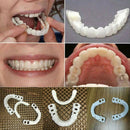 1Pair Teeth Veneers Perfect Smile Cosmetic Snap On Comfort Covers Upper BottomOZ