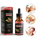 Skin Whitening Oil Brightening Dark Spot Removal 30ml Quality Essence Care V6S1