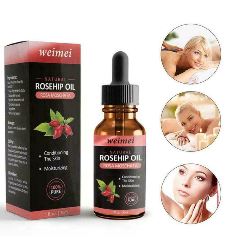 Skin Whitening Oil Brightening Dark Spot Removal 30ml Quality Essence Care V6S1