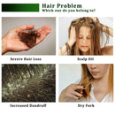 Fast Hair Growth Essence Fast Powerful Hair Loss Product Beard Serum Oil Gr I4R8