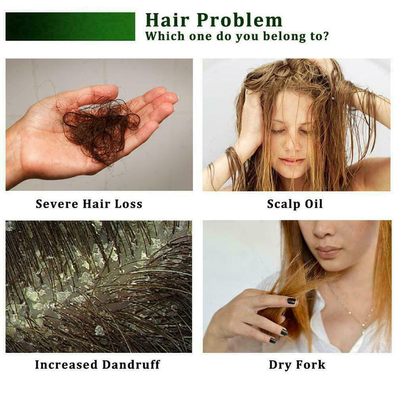 Fast Hair Growth Essence Fast Powerful Hair Loss Product Beard Serum Oil Gr I4R8