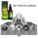 Herbal Ginger Essence for Hair Growth Hair Essential Oil Anti Hair Lose 30ml