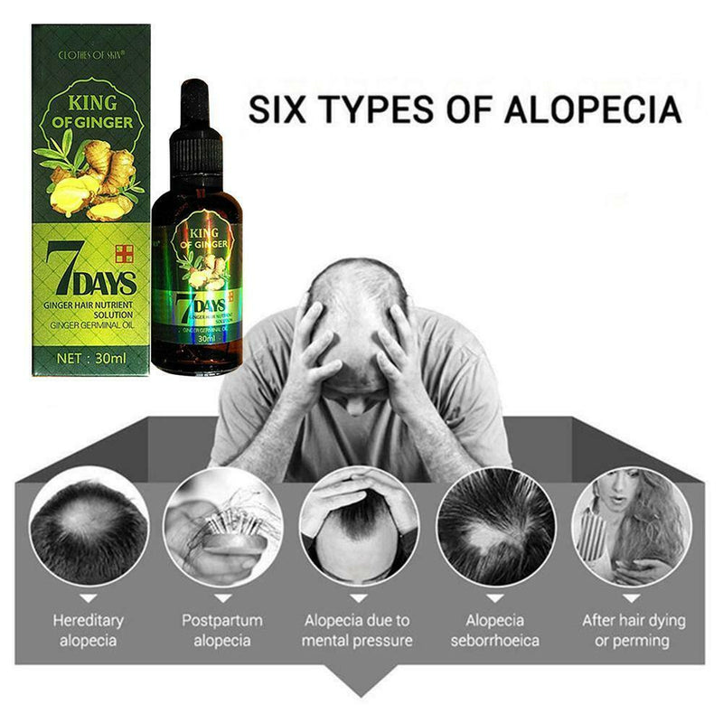 Herbal Ginger Essence for Hair Growth Hair Essential Oil Anti Hair Lose 30ml