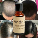 Hair Growth Liquid Oil Natural Organic Regrowth Treatment Hot