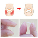 Ingrown Toenail Pedicure Tool 10Pcs/Bottle Straightening Clip Curved Bs Bra D8Q1