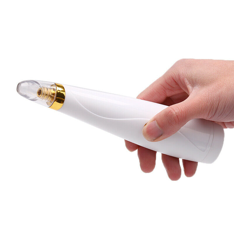 Electric Blackhead Remover Pore Vacuum Suction Dermabrasion Face Clean&+