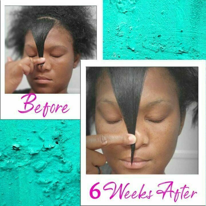 Hair Regrowth Serum Perfect Hair Essential Oil 30ml F6H4