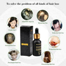 20Ml Natural Hair Growth Serum Essence Oil Hair Fiber Hair best Faster Grow W6S9