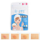 Universal Acne Absorbing Cover Heal Skin Blemish Spot Acne Stickers 30 Dots Z