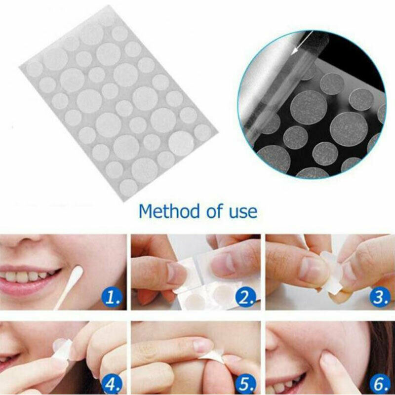 36PCS Fast Remover Pimple Patch Treatment Acne Patch Skin Tag Beauty Makeup  Nw