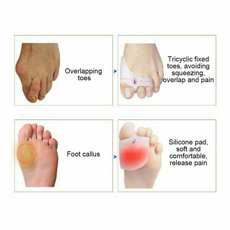 Silicone Pad For Hammer Toe Pain Relief Bunion Corrector I6L8 Orth Toe Sepa I1X4