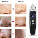 Electric Acne Blackhead Vacuum Cleaner Skin Care Tool Nose Clean Face Pores I0B8