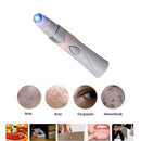 Rechargeable Blue Pointer Strong Anti-Venous Varicose Facial Acne Removal P
